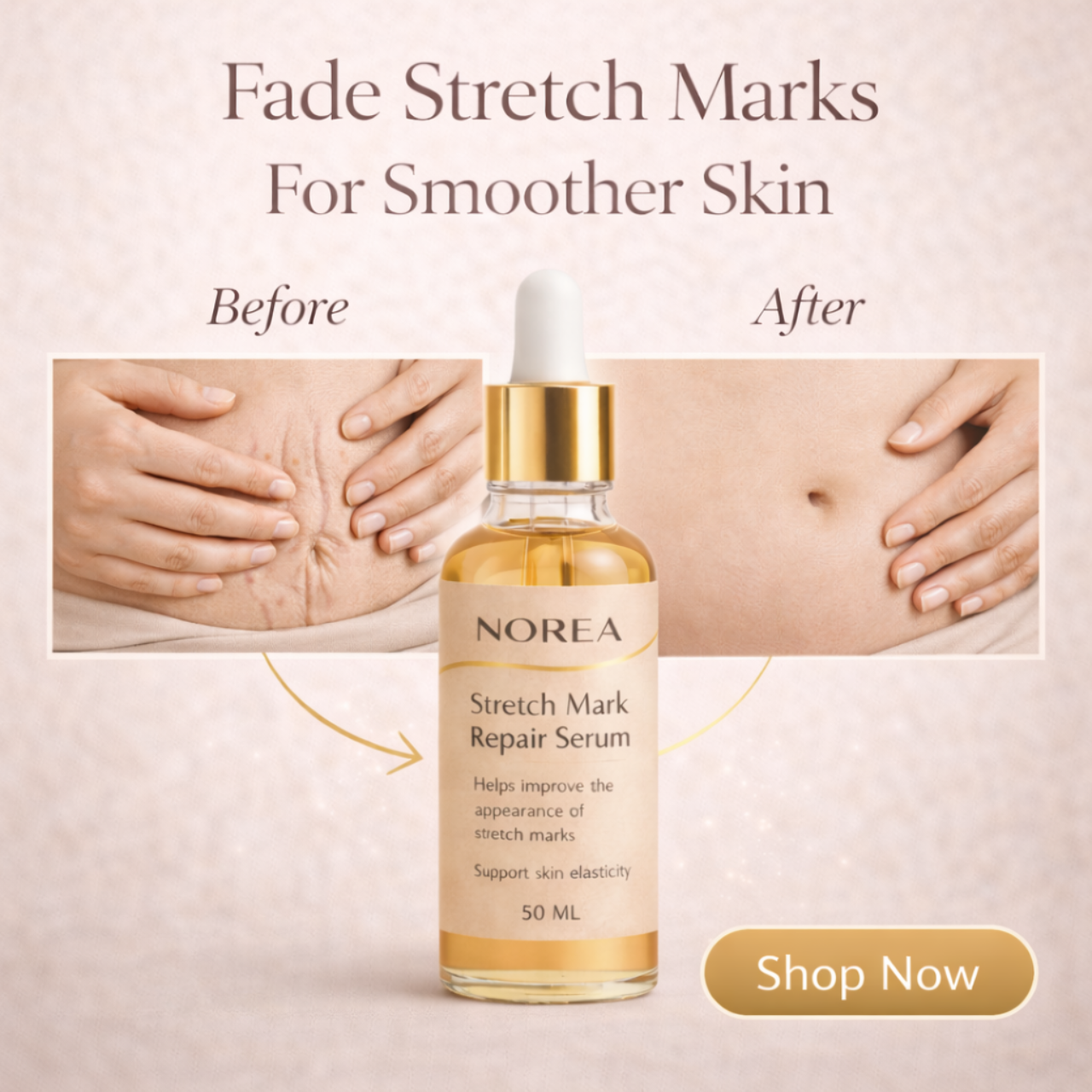 NOREA Stretch Mark Repair Serum
